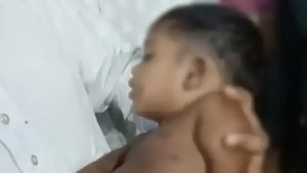 মাদারীপুরে ভিমরুলের কামড়ে তিন বছর বয়সী শিশুর মৃত্যু
