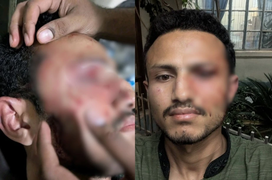 চাকসুর পাঠাগার ও ক্যাফেটেরিয়া সম্পাদককে পিটিয়ে জখম