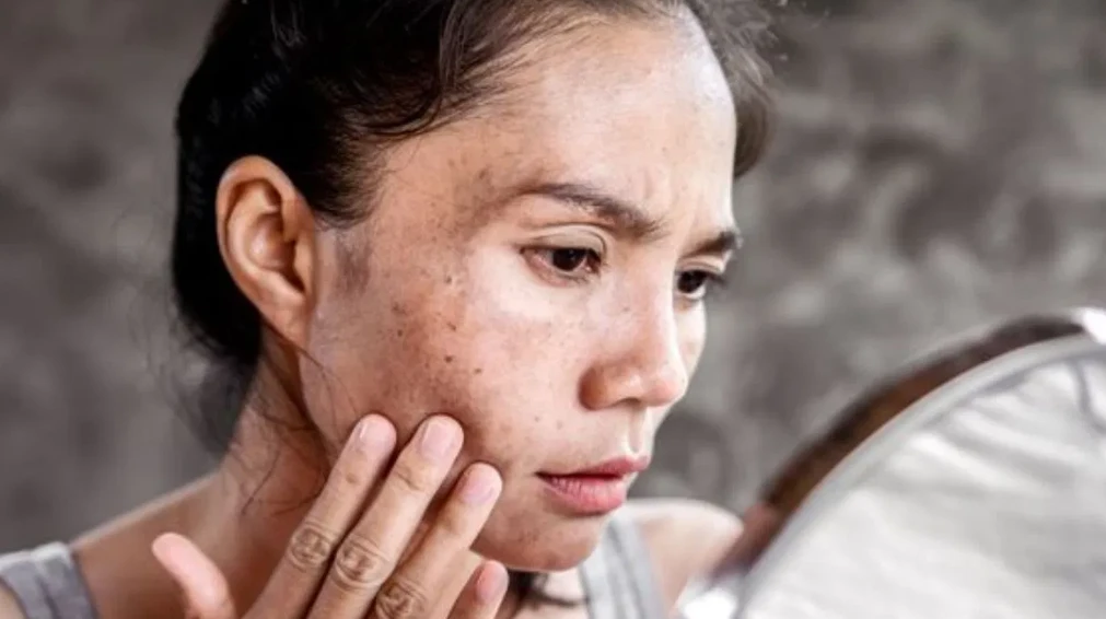 Dry Skin? আর নয়! শীতকালে ত্বককে রাখুন নরম, মসৃণ ও সুস্থ