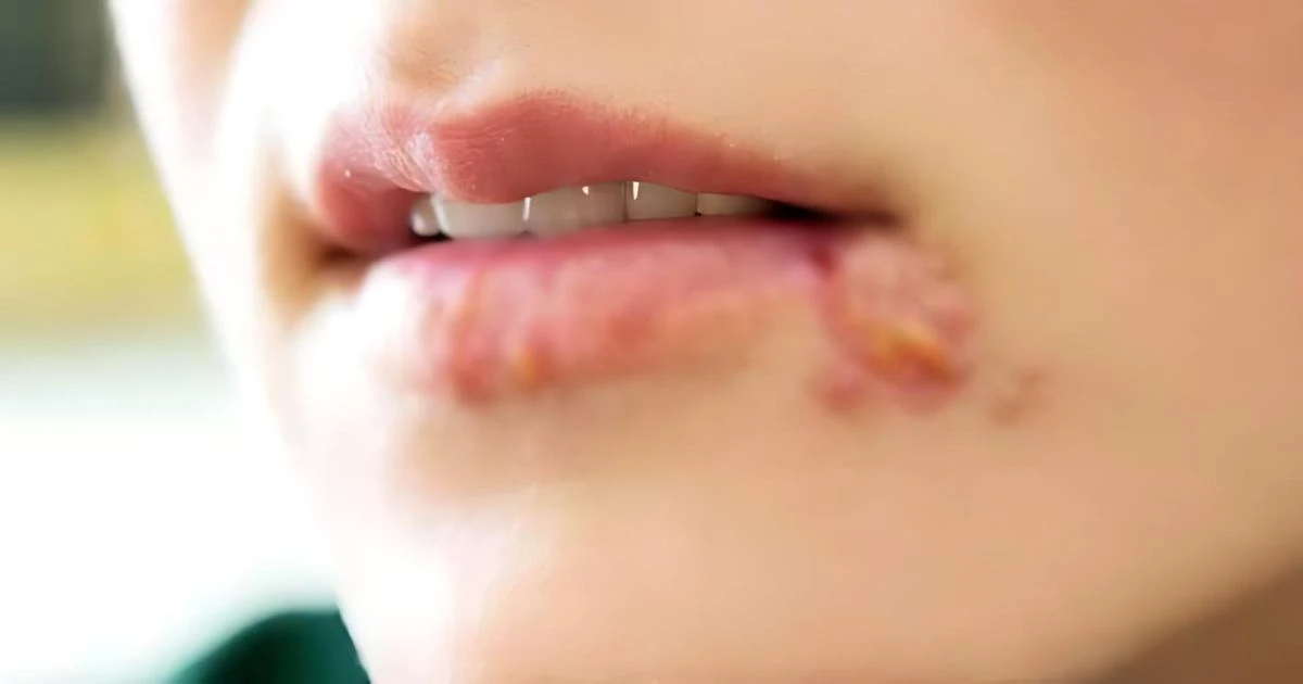 সাবধান! জ্বর-ঠুসা কি অন্য রোগ ডেকে আনছে? বিস্তারিত জানুন