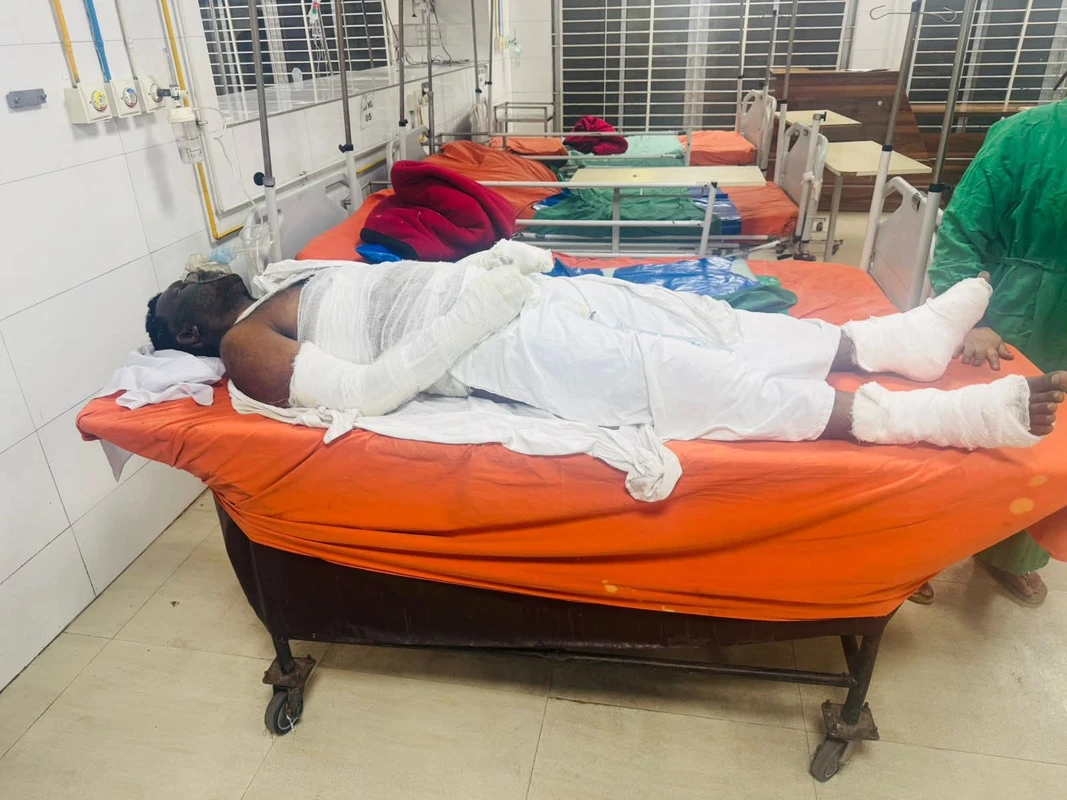 জাবি শিক্ষার্থীসহ আগুনে দগ্ধ চার