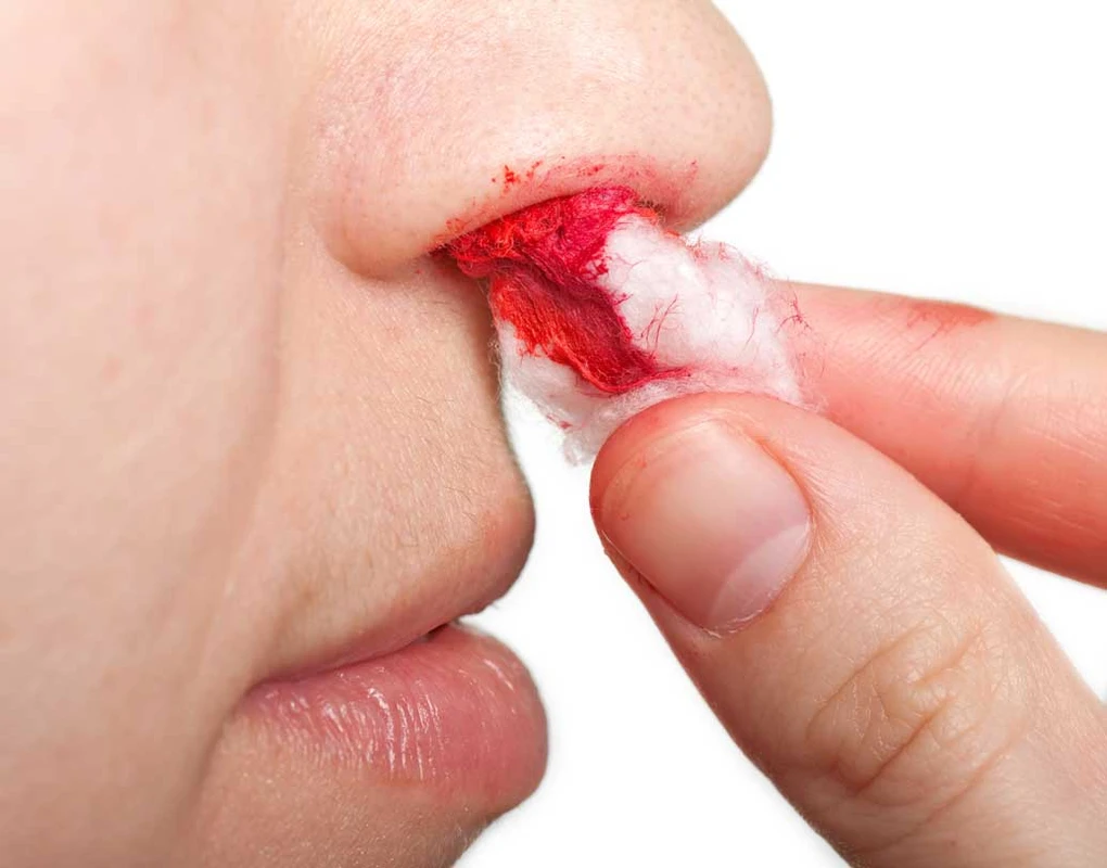 শীতে হঠাৎ নাক থেকে রক্ত! চিন্তার কারণ নাকি সাধারণ সমস্যা?