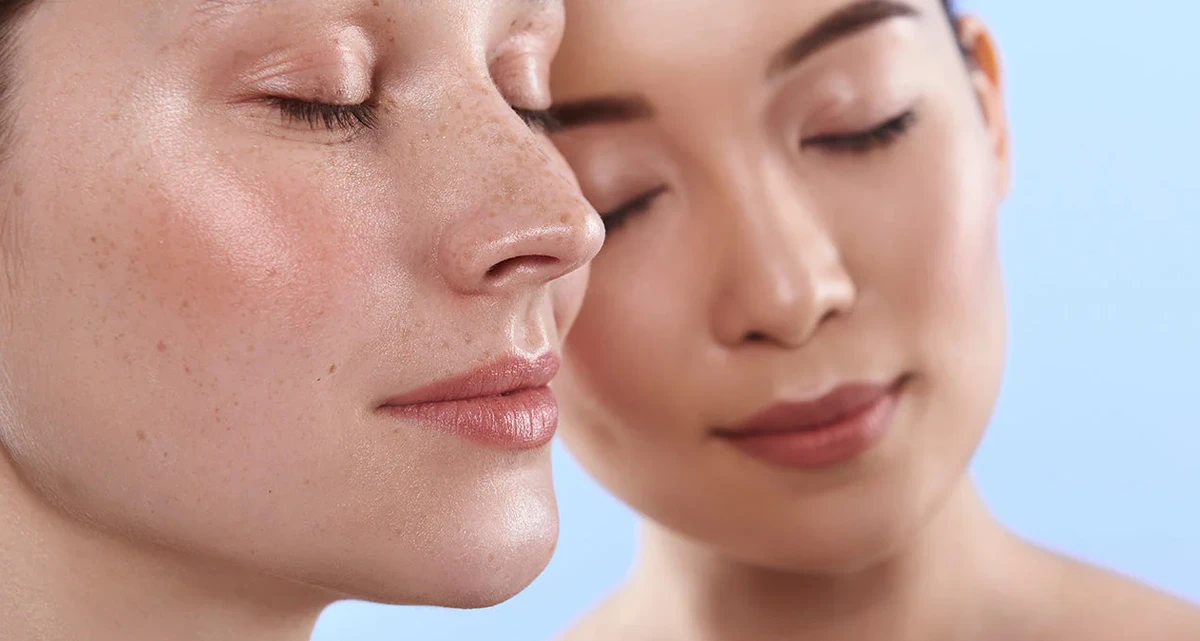 সেনসিটিভ স্কিন নিয়ে দুশ্চিন্তা? জেনে নিন প্রাকৃতিক যত্নের সঠিক নিয়ম