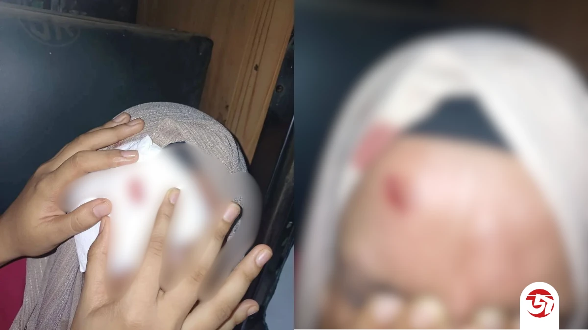 আবারও চবি শাটলে পাথর নিক্ষেপ, এবার আহত নারী শিক্ষার্থী