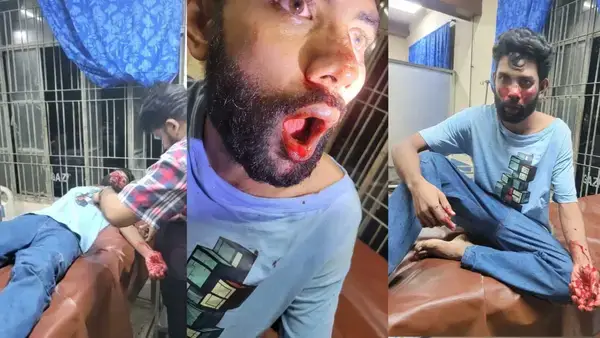 চবিতে নারী শিক্ষার্থীকে হয়রানির অভিযোগ, মারামারিতে আহত একজন