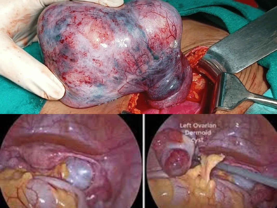শরীরের ভেতরে নীরবে বাড়তে থাকা ‘অন্য দেহ!-ডারময়েড সিস্ট নিয়ে চমকপ্রদ মেডিকেল তথ্য