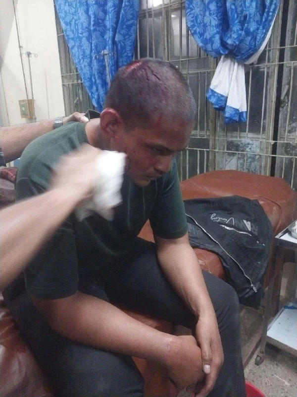 চবিতে চারুকলা শিক্ষার্থীকে মারধর, ছাত্রদল নেতাদের বিরুদ্ধে অভিযোগপত্র