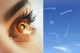 চোখের সামনে ভেসে বেড়ানো দাগ, সতর্কতা নাকি স্বাভাবিক ঘটনা?