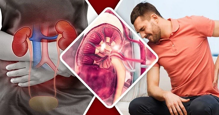 কিডনি ভালো আছে কি না,বুঝবেন যেভাবে