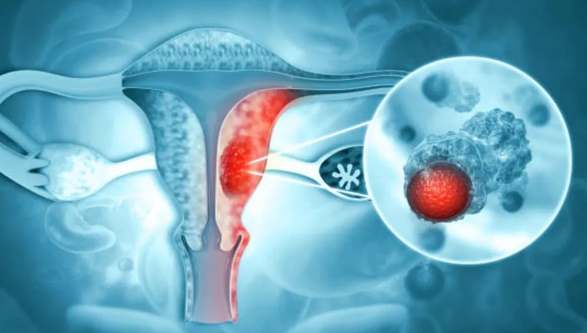 একটি টেস্ট, একটি ভ্যাকসিনেই জরায়ু ক্যানসার মুক্ত থাকুক প্রতিটি জীবন!